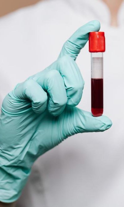 nurse-holding-blood-test-tube
